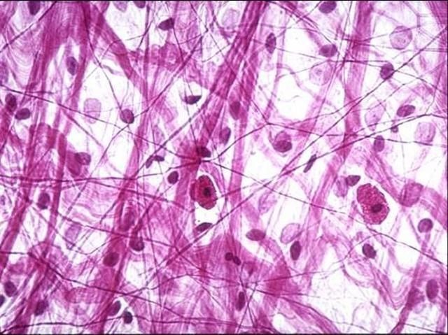 <p>What is this tissue?</p>