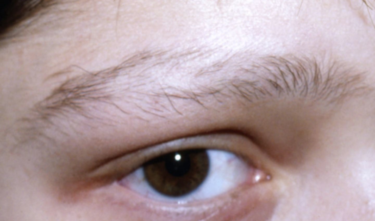 <p>What is the diagnosis?</p>