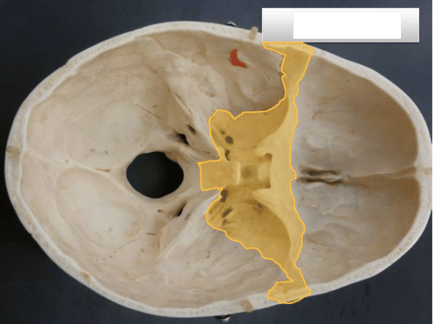 <p>yellow highlighted</p>