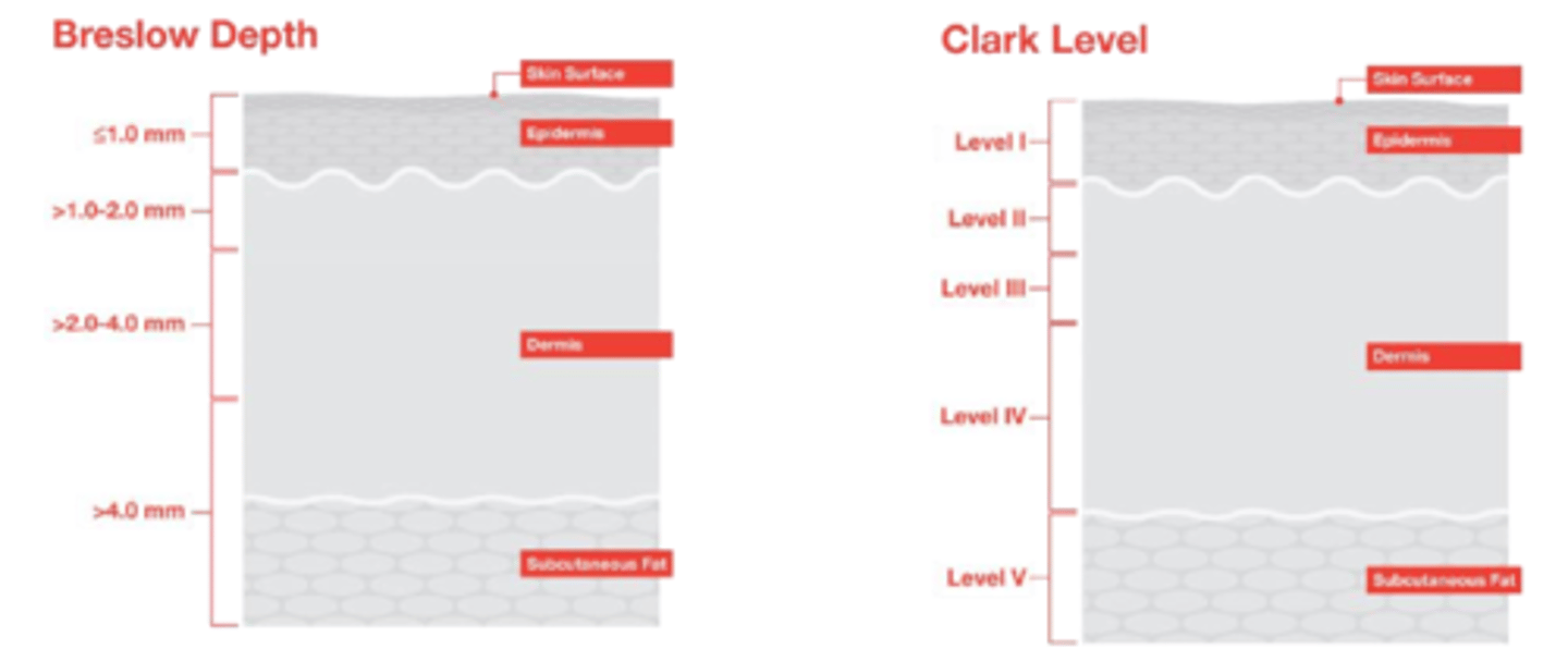 <p>Breslow depth</p><p>Clark level (also depth)</p>