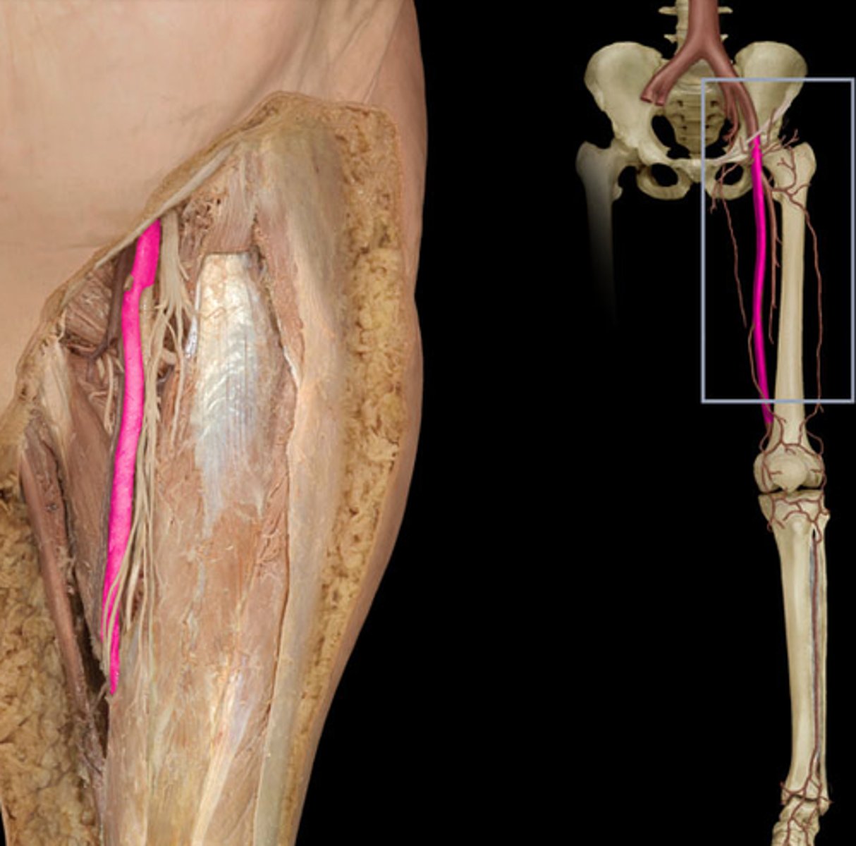 <p>Identify the vessel (include artery vs vein)</p>