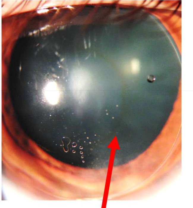 <p>Name the finding.</p>