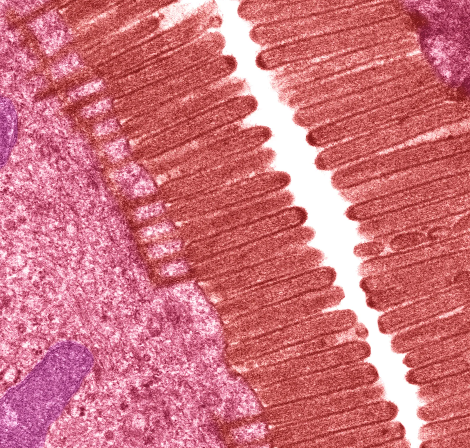 <p>Microscopic, non-motile apical projections for increased absorption surface area.</p>