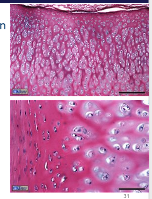 <p>Typical form of cartilage</p><p>Found:</p><ul><li><p>joint surfaces including synovial joints and sternum</p></li><li><p>precursors to bone in embryonic skeleton (embryonic ossification)</p></li><li><p>present inside bones, serving as a centre of ossification or bone growth</p></li><li><p>predominantly type 2 collagen.</p></li></ul><p>Function:</p><ul><li><p>withstand and distribute load</p></li><li><p>act as an elastic shock absorber</p></li><li><p>provides a wear resistant surface to articulating joints</p></li><li><p>self maintaining</p></li><li><p>avascular, aneural and alymphatic</p></li></ul><p></p>