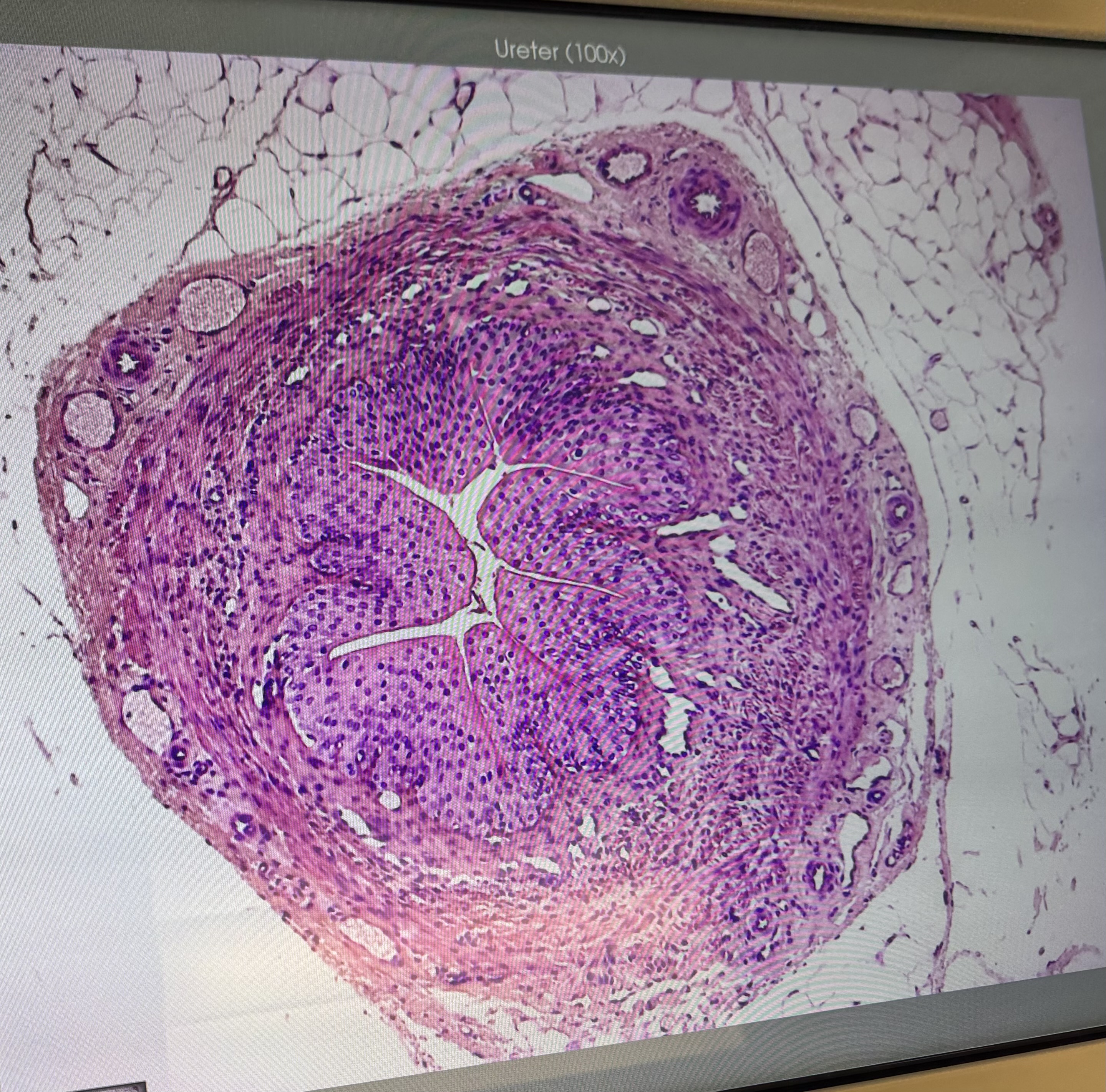 <p>Ureter (#10012): what kind of ET?</p>