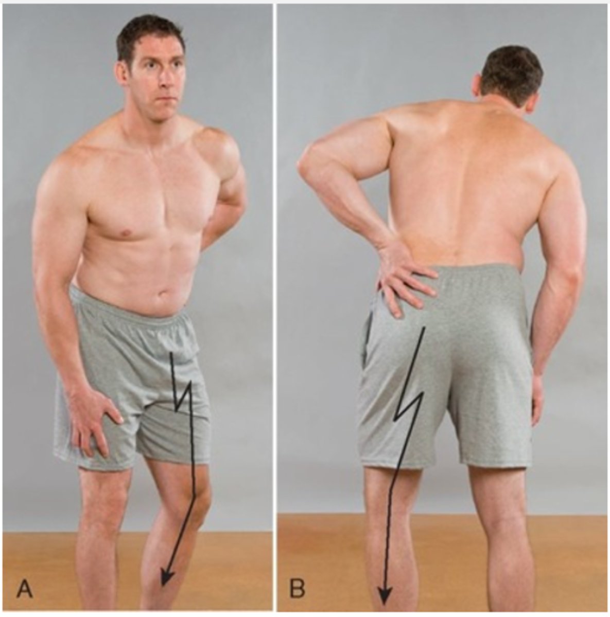 <p>Assessment for:</p><p>- Posterolateral disc protrusion</p><p>- Posteromedial disc protrusion</p><p>- Posterocentral disc protrusion</p>