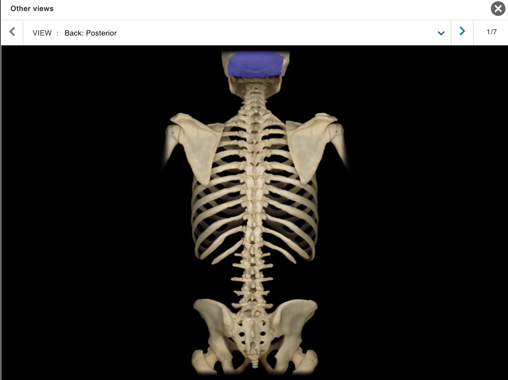 <p>Location:</p><p class="p1">• Skull (posterior and inferior)</p><p class="p1">Description:</p><ul><li><p>﻿﻿Irregular-shaped bone</p></li><li><p>﻿﻿Contains foramen magnum in central portion</p></li></ul><p class="p1">Comment:</p><ul><li><p>﻿﻿Forms most of posterior skull</p></li><li><p>﻿﻿Forms most of posterior cranial fossa</p></li><li><p>﻿﻿Articulates with parietal bone at lambdoid suture, temporal bone at occipitomastoid and other sutures, and sphenoid bone at spheno-occipital synchondrosis</p></li><li><p>﻿﻿Articulates with atlas (C1 vertebra)</p></li></ul><p></p>