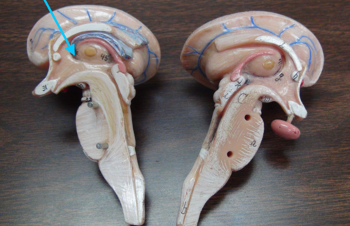 <p>3rd ventricle, the little hole</p>