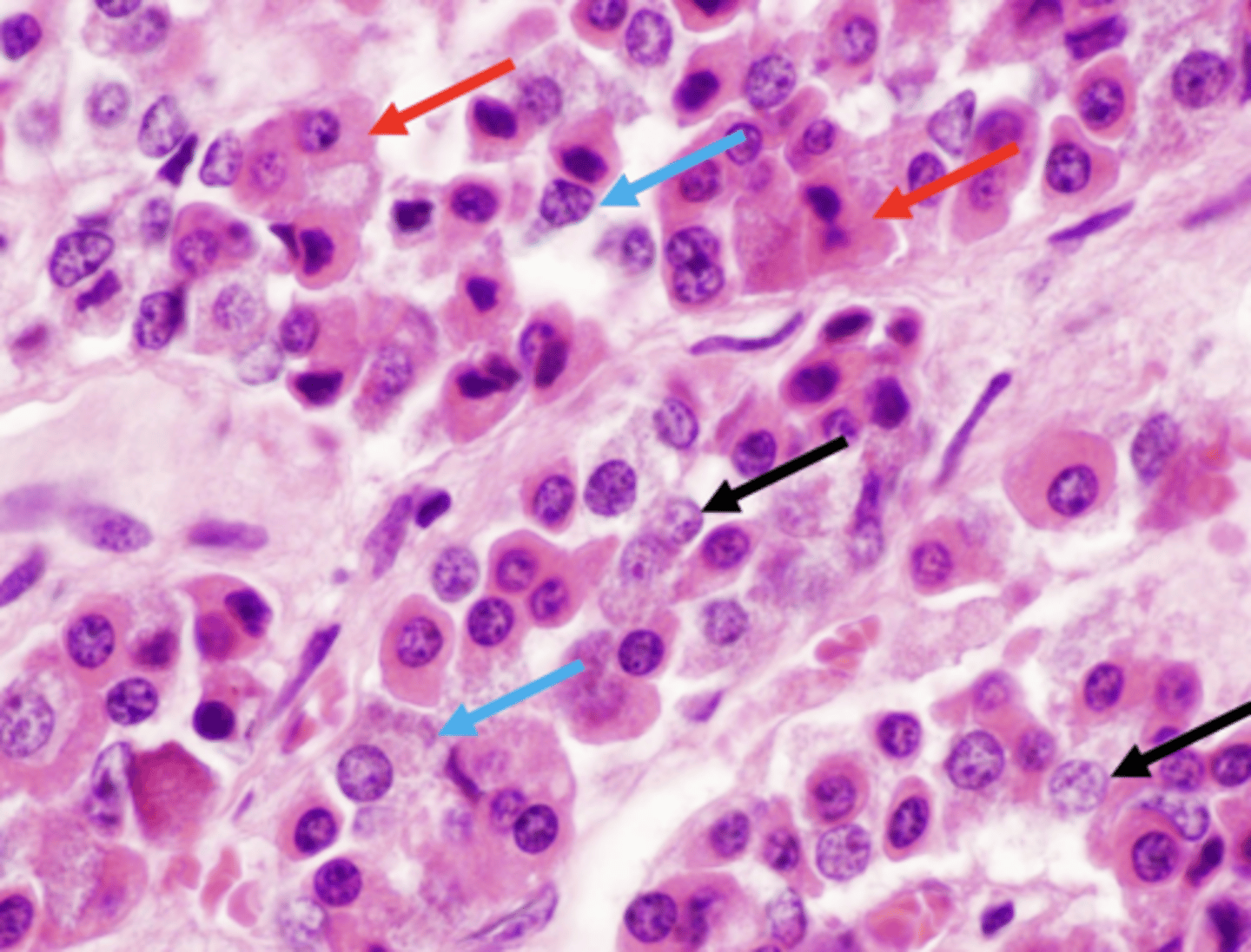 <p>what cells compose the pars distalis?</p>