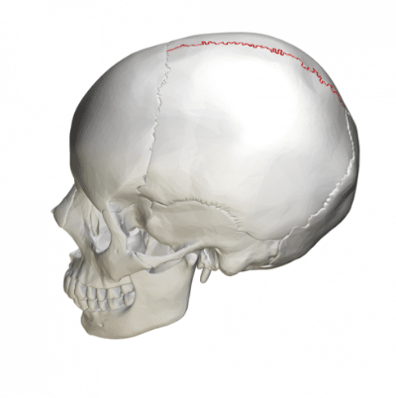 <p>What suture is this?</p>