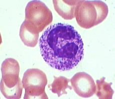 <p>more inclusions in the cytoplasm of WBC seen as darker staining of neutrophils</p>
