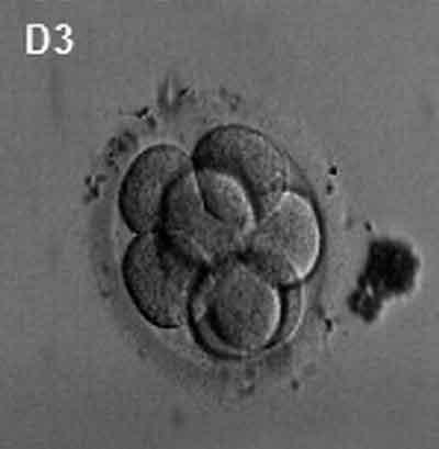 <p>Blastomeres reorganise into inner embryoblast cells and outer trophoblast cells (now termed a blastocyst)</p>