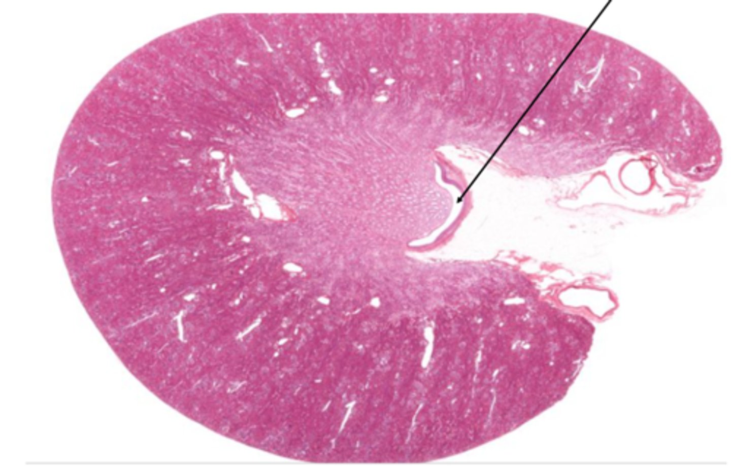 <p>Identify the structure on the kidney</p>