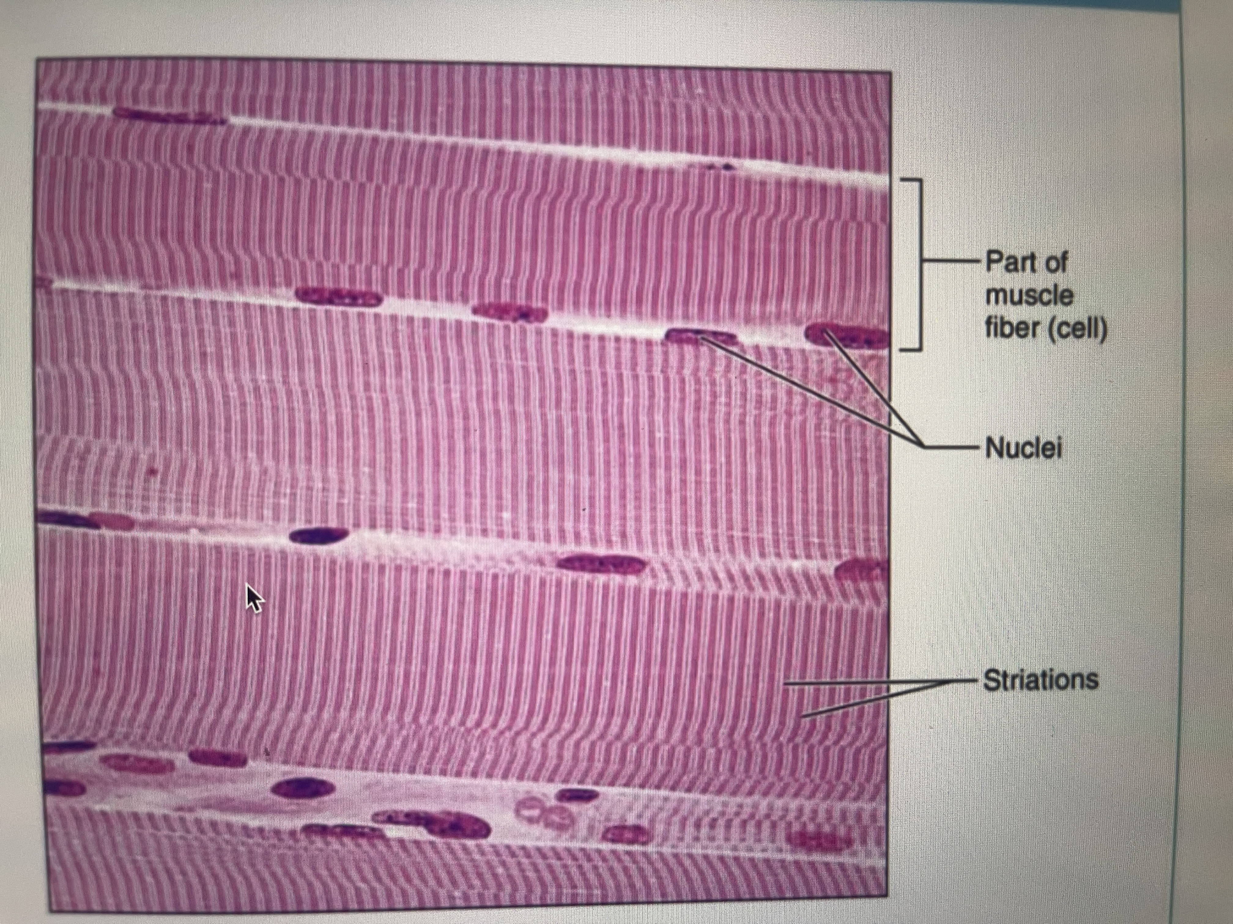 <p></p><ul><li><p>voluntary muscle(under our conscious control)</p></li><li><p>has striations</p></li><li><p>called muscle fibers- long and cylindrical</p></li><li><p>multiple nuclei</p></li><li><p>have myofilaments</p></li></ul>