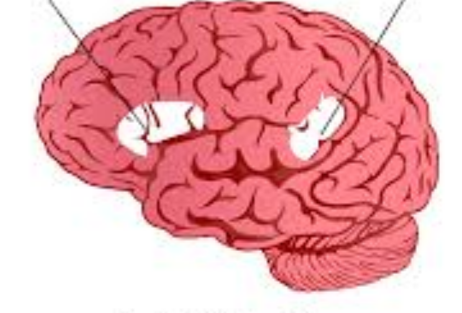 <p>What is the patch on the left called</p>