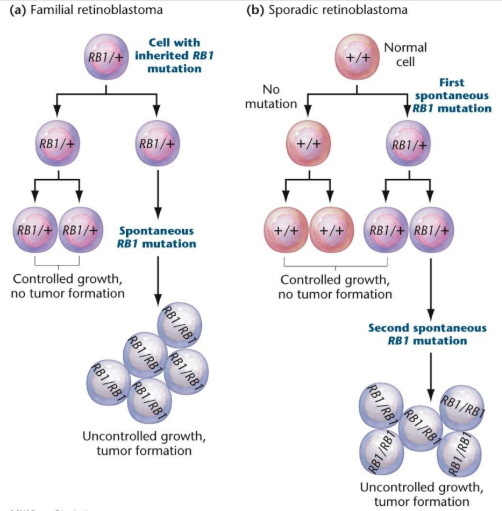 <p>Rb gene (-ve regulator of transcription)</p><ul><li><p>patients with hereditary form inherit loss or mutation in one gene copy and are predisposed to developing cancer</p></li><li><p>sporadic event requires 2 independent mutations</p></li></ul><p></p>