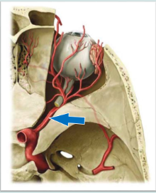 <p>What is the name of this blood vessel, and what artery does it branch off of?</p>
