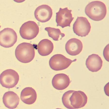 <p>What do these erythrocytes show?</p>