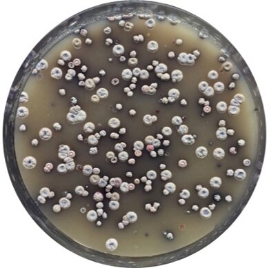 <p>Macroscopic morphology</p>