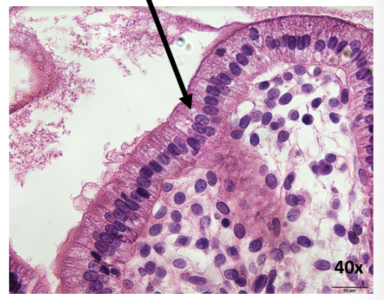<p>What is this epithelial tissue?</p>