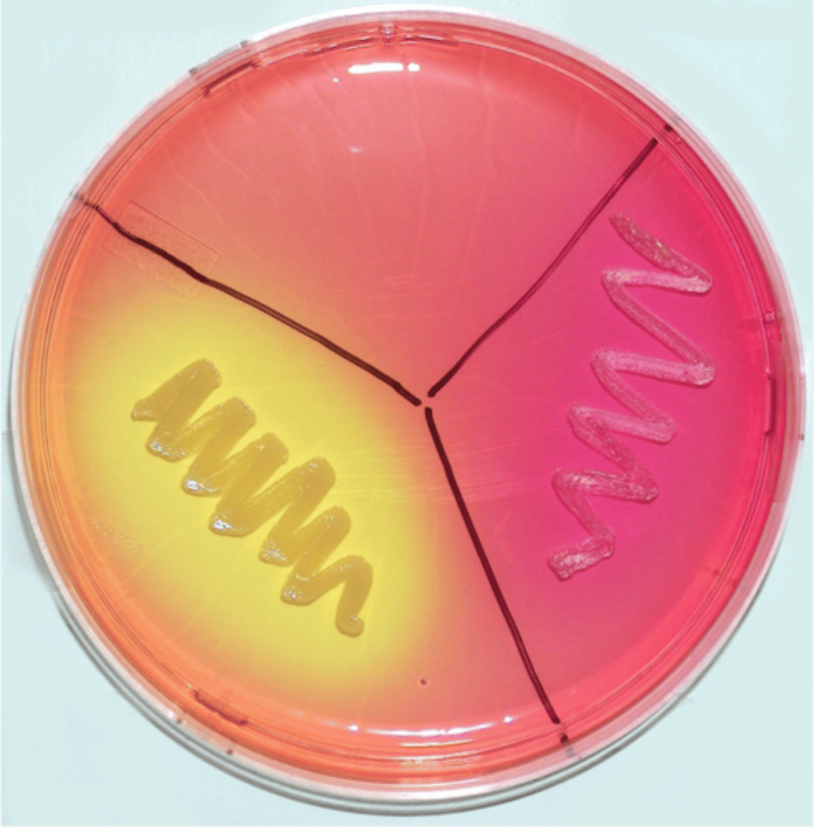 <p>sugar mannitol - can ferment mannitol (yellow line)</p>