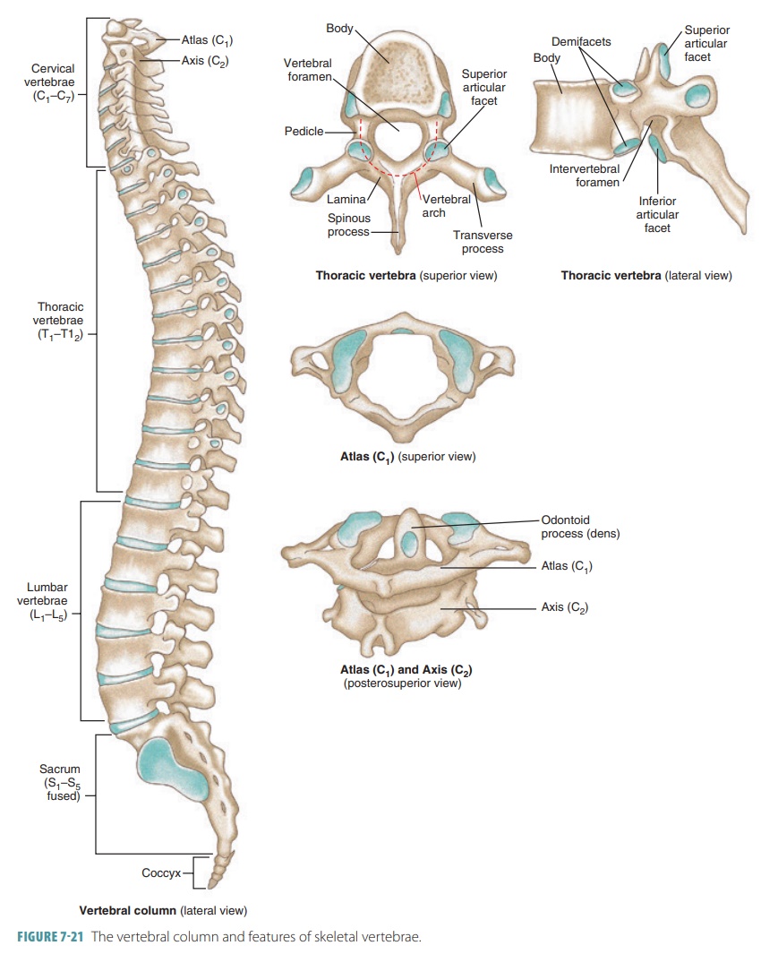 <p>First cervical vertebra that articulates with occipital condyles; supports the head.</p>