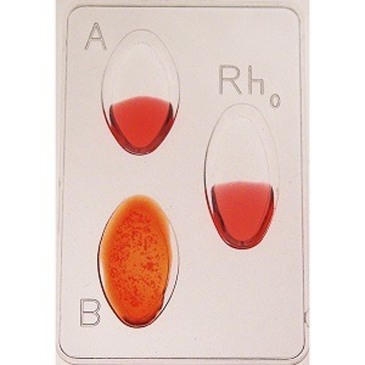 <p>What is the blood type?</p>
