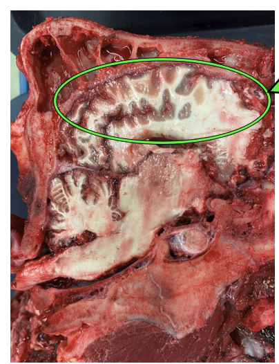 <p>The most superficial layer of the brain, found in the cerebrum. Involved in the conscious treatment of sensory information and elaboration of complex conscious motor activity. </p><p>The site of a high level of association (communication between multiple parts) and educability (learning and memorizing).</p><p>Highly convoluted but corresponds to a single layer folded over and over to maximize use of space under the skull - if flat, would look like a pancake with gray layer on top and white layer underneath.</p>