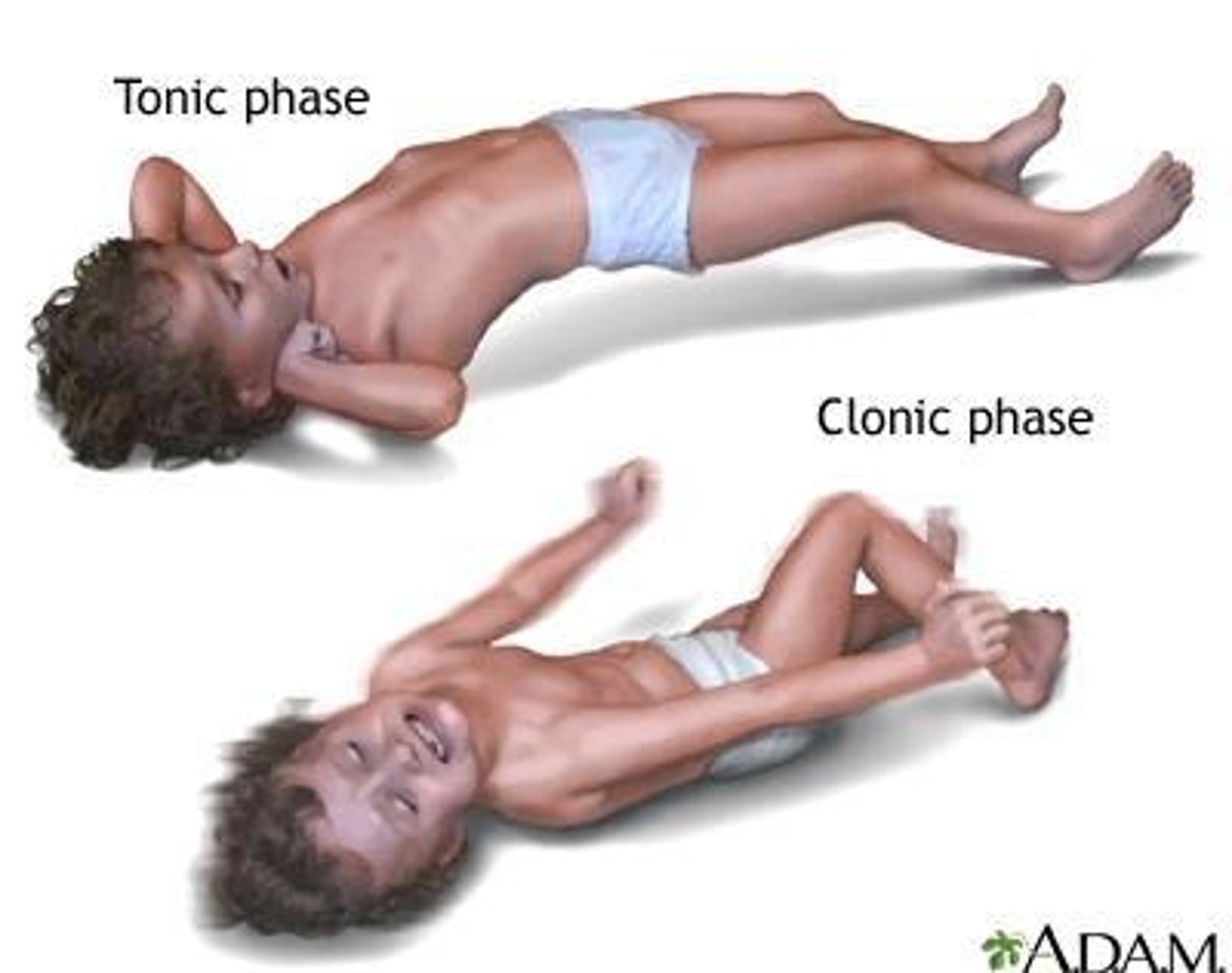 <p>Abnormal discharges in cortex altering sensation or behavior.</p>