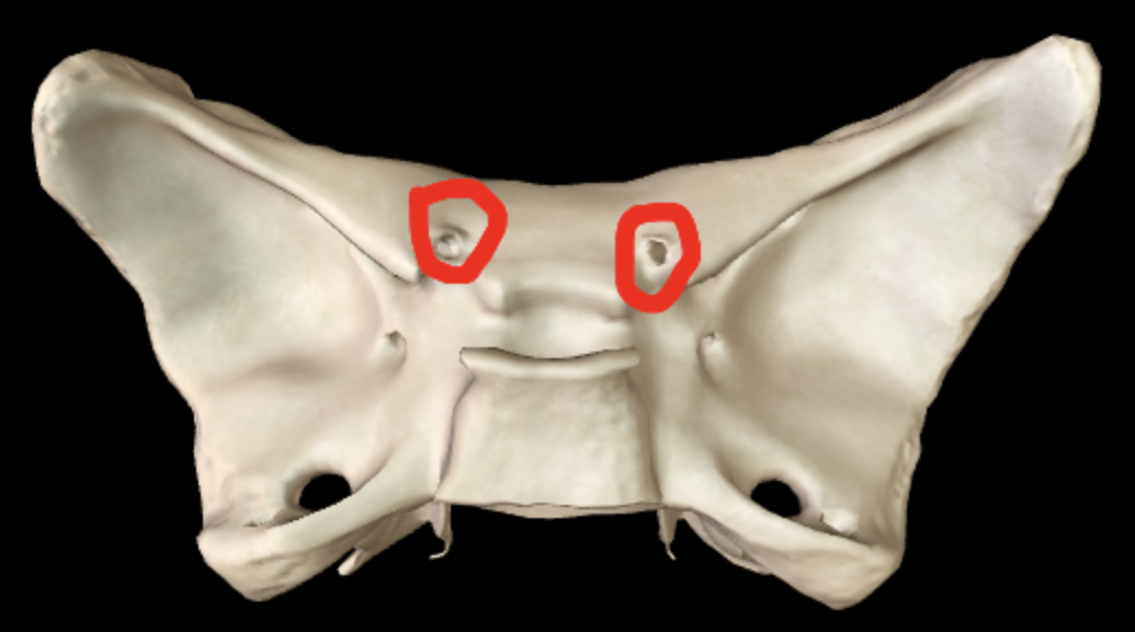 <p>What part of the sphenoid is this?</p>