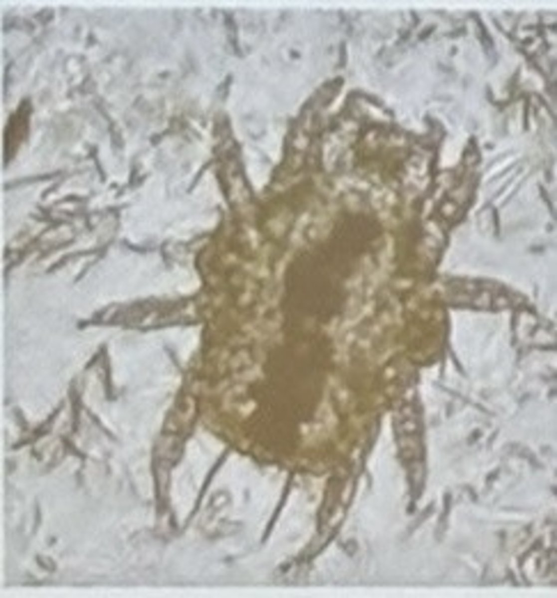 <p>Cheyletiella spp.</p><p>3 multiple choice options</p>