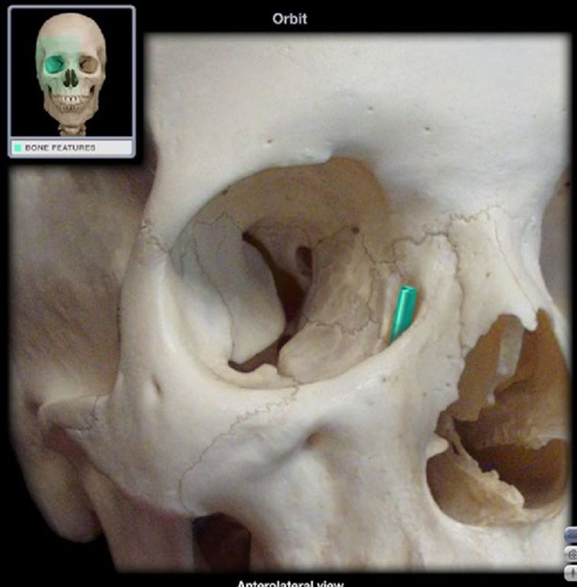 <p>houses lacrimal sac</p>