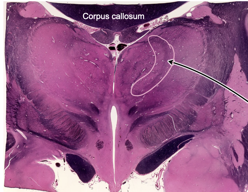 <p>what is the structure outline in pink?</p>