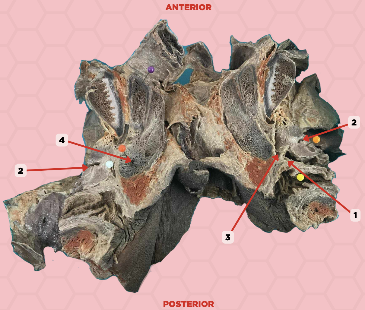 <p>Identify the structure labeled as 2.</p>