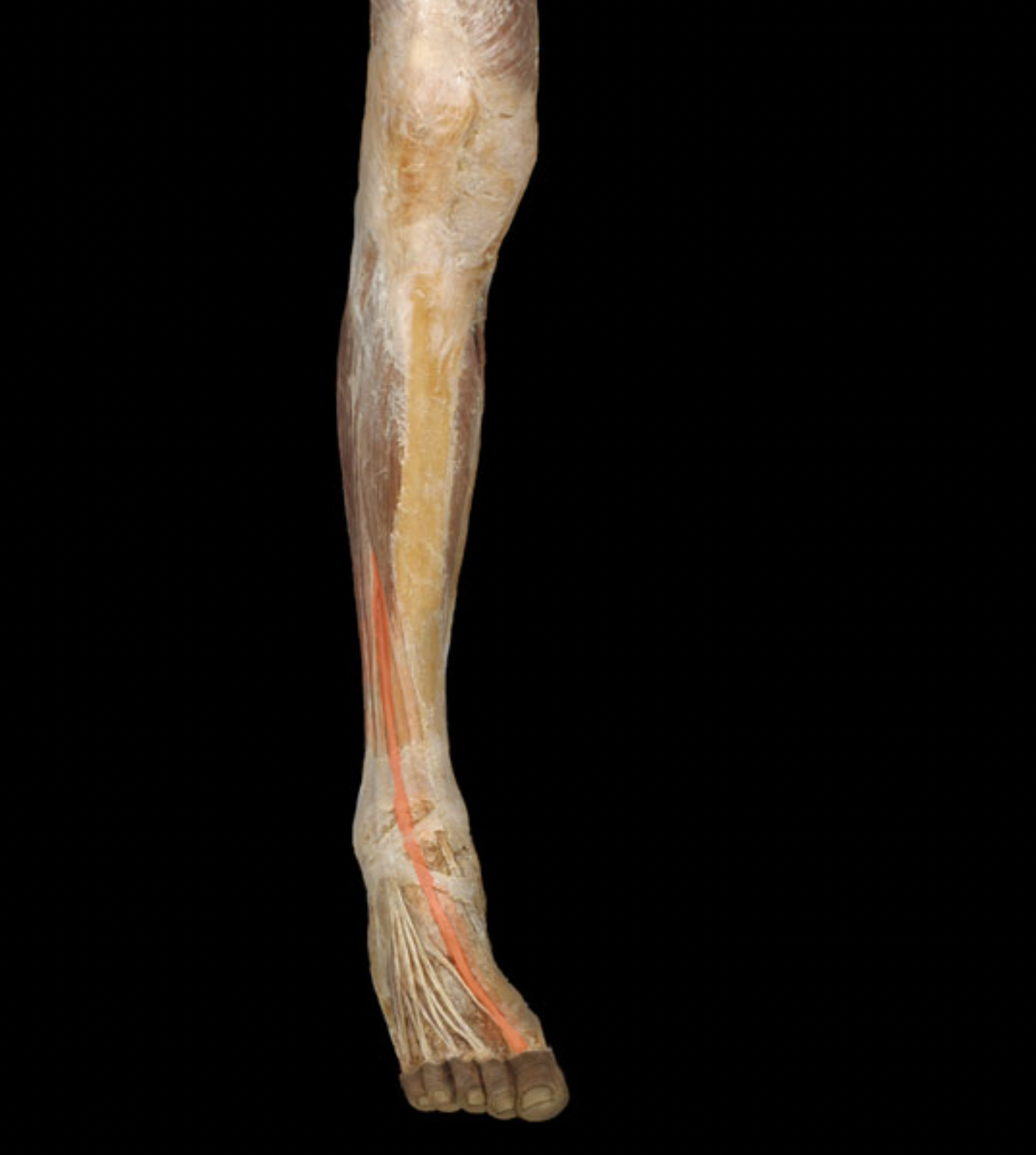 term image