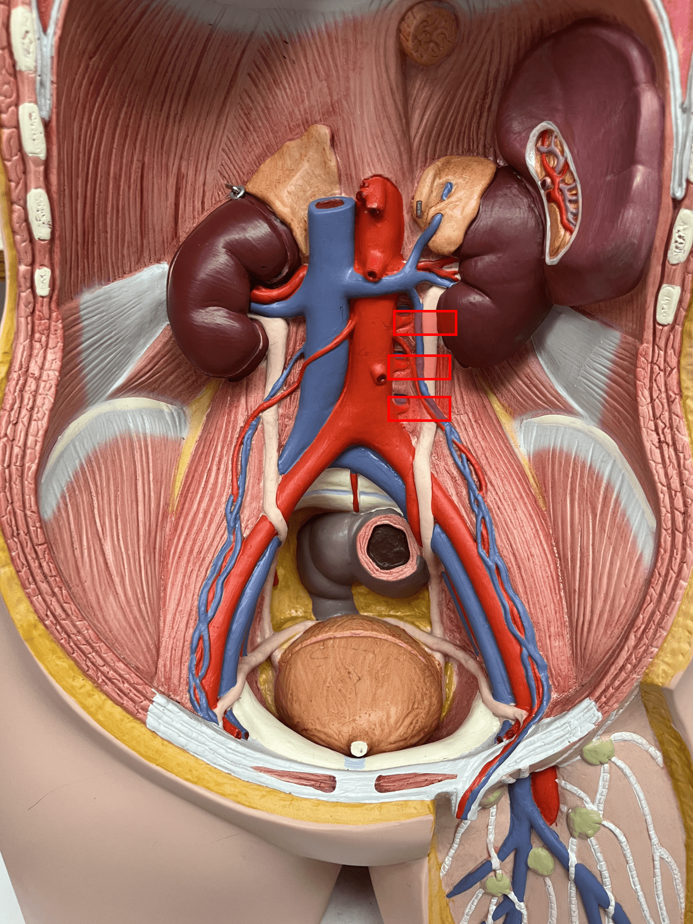 <p>• An artery of the abdomen.</p>
<p>• Originates from the abdominal aorta.</p>
<p>• Supplies the spinal cord and dorsal abdominal wall.</p>