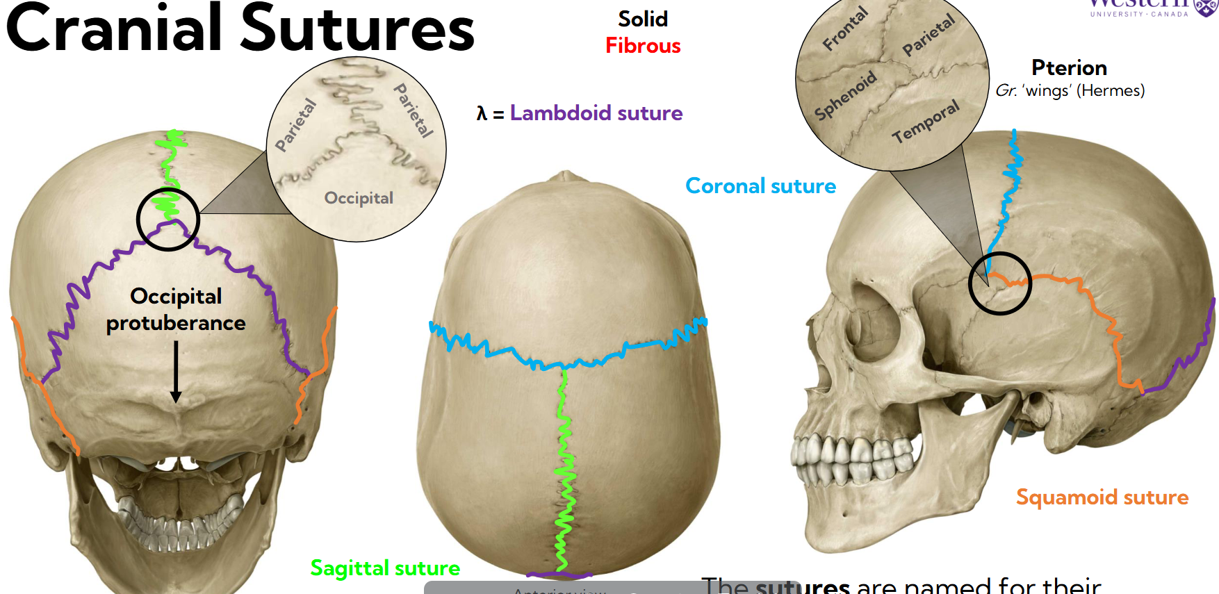 <p>Lamoid suture </p><p>Sagittal suture </p><p>Coronal suture </p><p>Squamoid suture </p>