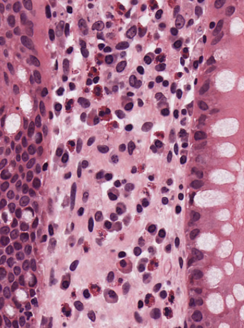 <p>What type of tissue is shown here?</p>
