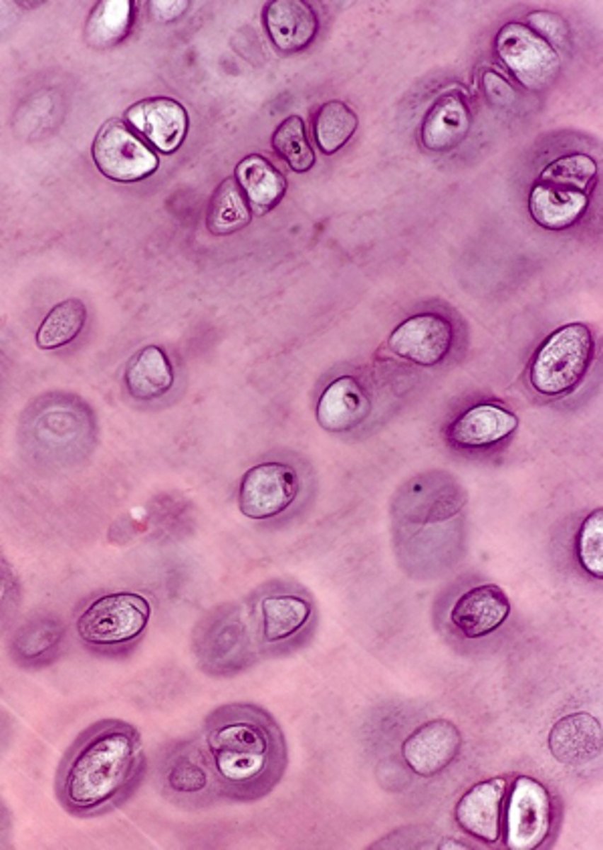 <p>identify the cartilage:</p>