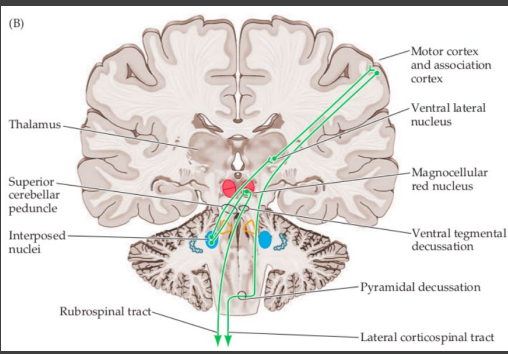 <p><strong>Localization of Cerebellar Lesions</strong></p><p>-Cerebellar lesions usually cause ____________ ataxia due to “______ decussation” </p>