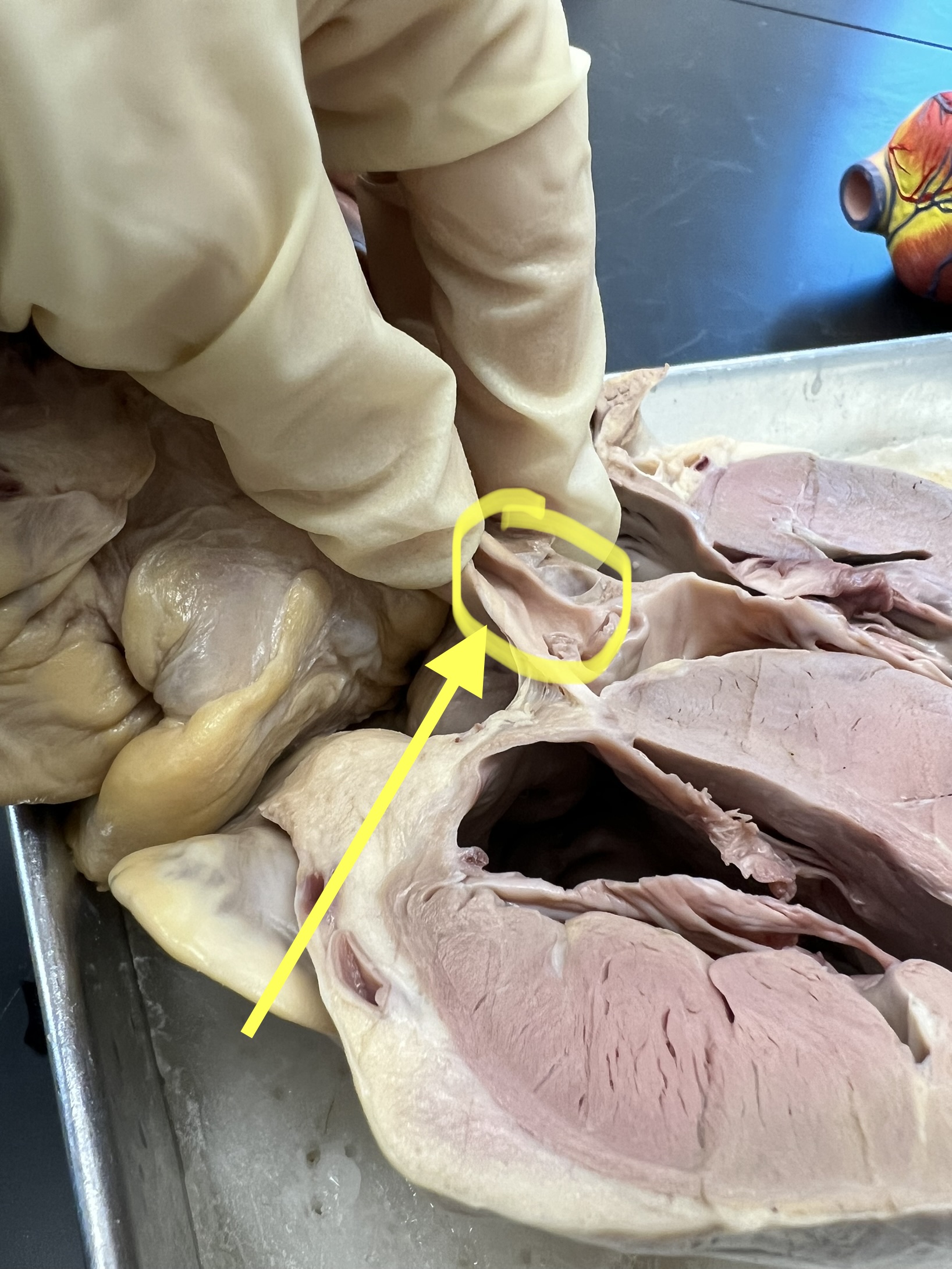 Name the heart structure.