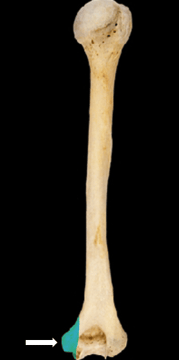<p>name the part</p>