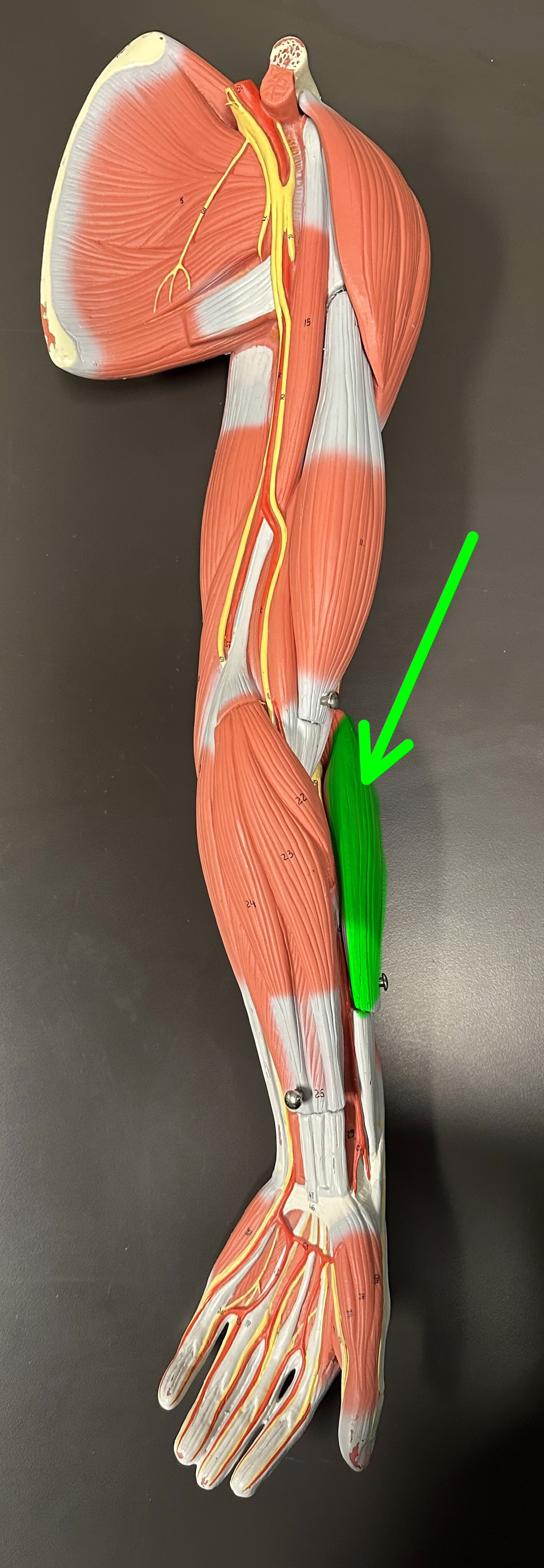 <p>What is the highlighted structure</p>