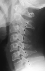 <p>Q what is the name of this measurement? and what is the average + range?</p>