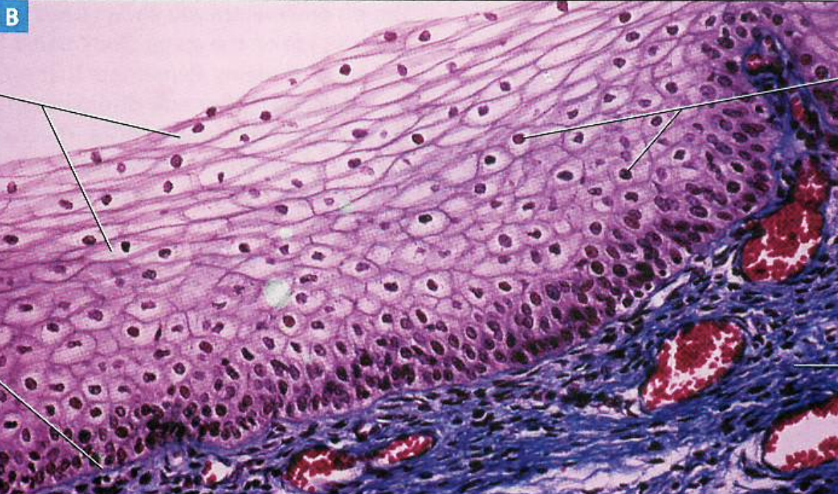 <p>What type of tissue is present in this image?</p>