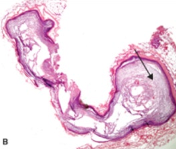 term image