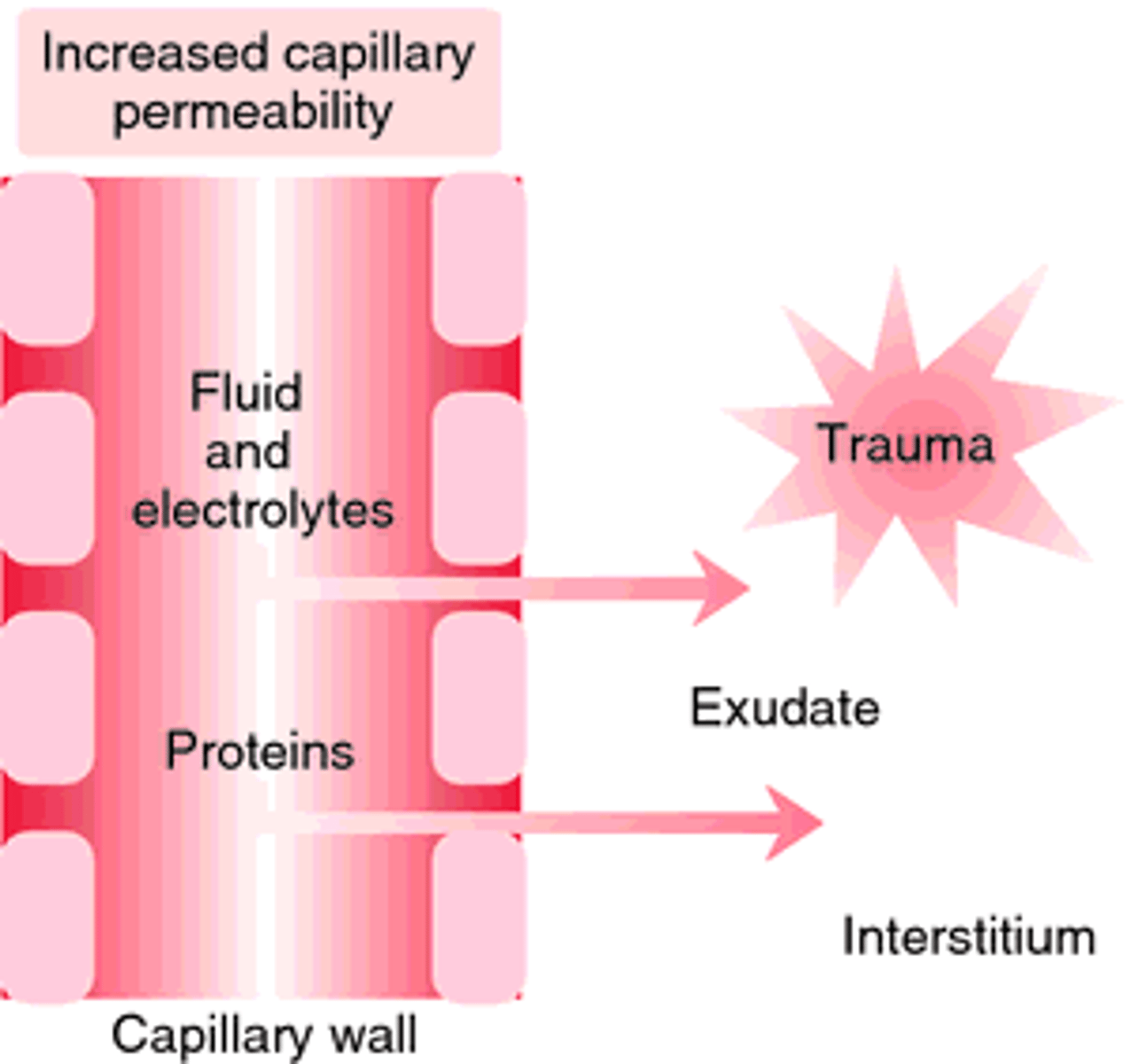 <p>- Pulmonary edema related congestive heart failure</p><p>- Decompensation occurs over days to weeks</p>