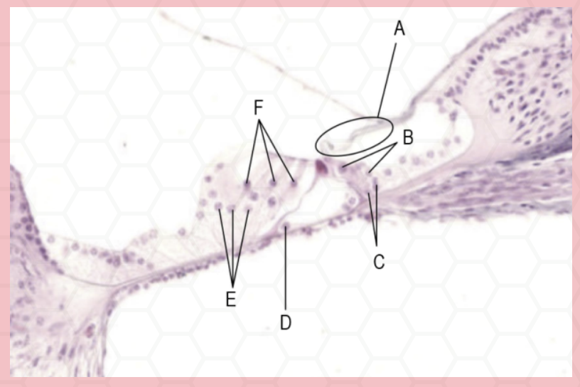 <p>Identify the structure labeled as A.</p>