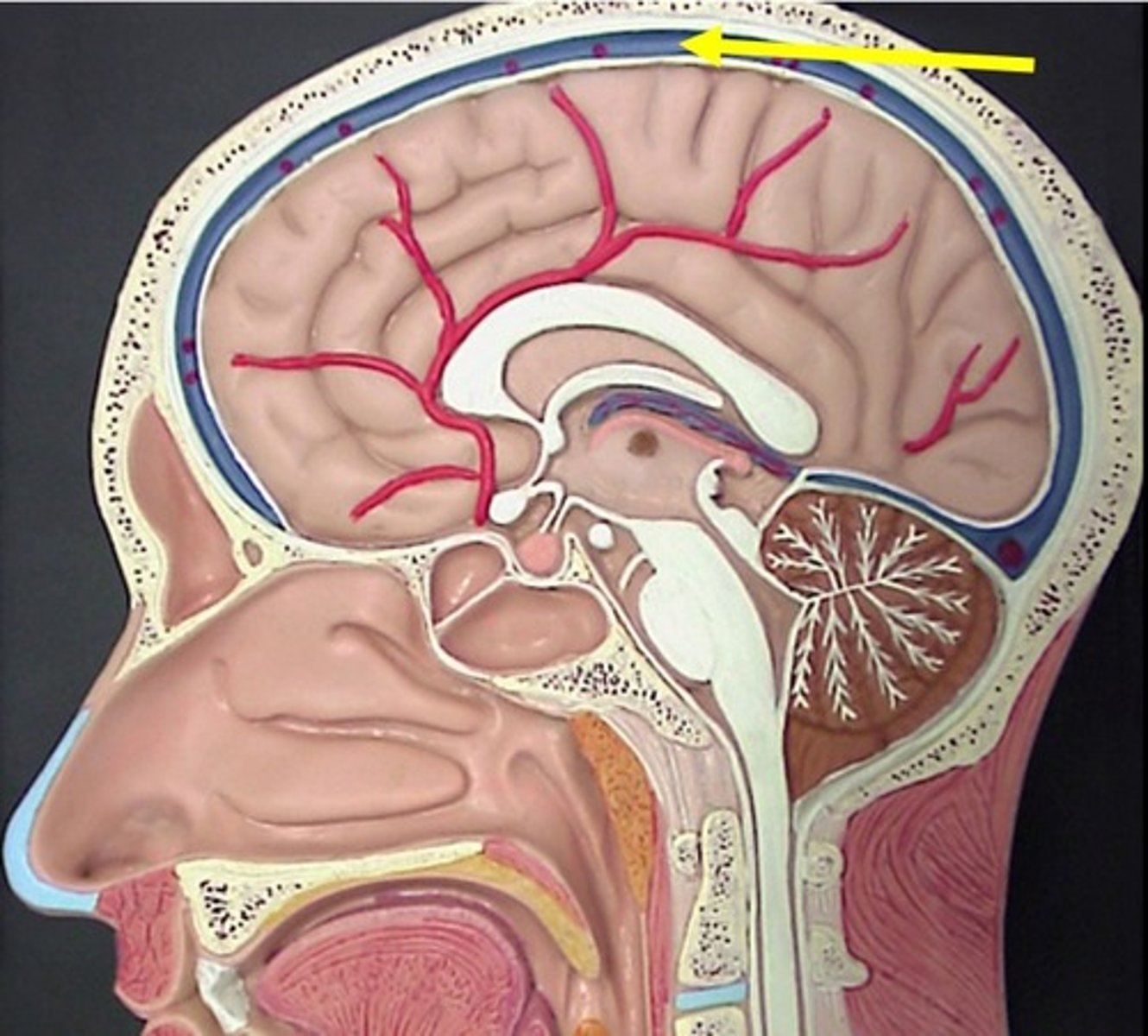 <p>upper border of falx cerebri</p>