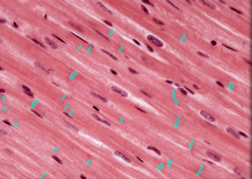 <p>What is this? (cardiac tissue histology)</p>